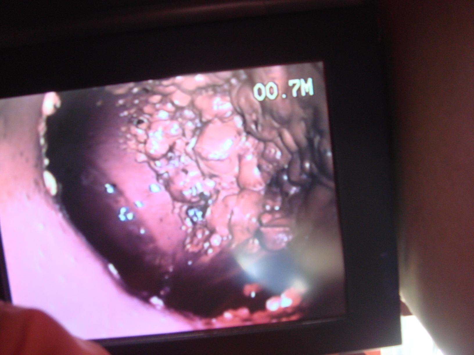 排水設備漏水調査の方法